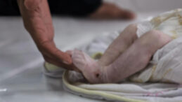 T&uuml;p Bebek Davası: 'Bebek Bize Benzemiyor'