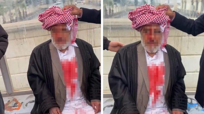 Yaşlı Adamı Darp Eden 4 Kişi Tutuklandı