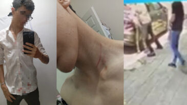 16 Yaşındaki Gen&ccedil; Sokakta Darbedildi! Verilen Cezaya Tepkiler Yağıyor