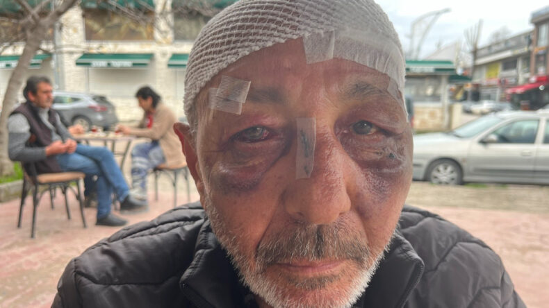 67 Yaşında: &Ccedil;akmak İstediler, Bu Hale Geldi