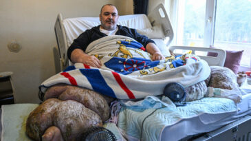 Duvarlar Kırıldı, 30 Kişi Taşıdı: 300 Kiloya Ulaşan Fil Hastası Ankara'ya G&ouml;nderildi