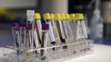 Hepatit C Uyarısı: Kapı Kapı Gezerek Vir&uuml;s&uuml; Yayabiliyorlar