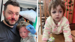 Kafatası Yaralanan Minik İkra Taburcu Oldu