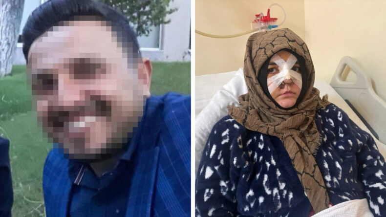 Kocası Tarafından Darp Edilen Kadın, Yaşadığı Korkun&ccedil; Anları Anlattı: "Hapisten &Ccedil;ıkarsa Yarım Bıraktığı İşi Tamamlayacak"