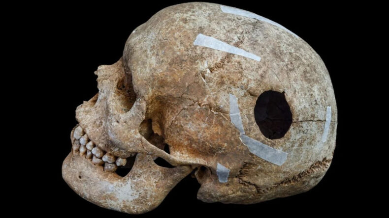 Viking Döneminden Kalma Kafatası Arkeologları Şaşırttı