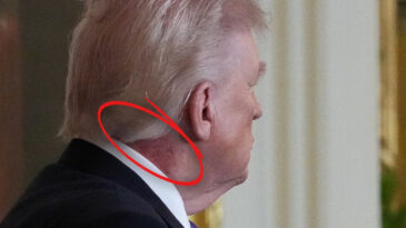 ABD&rsquo;de g&uuml;ndem Trump&rsquo;ın kızarıklığı