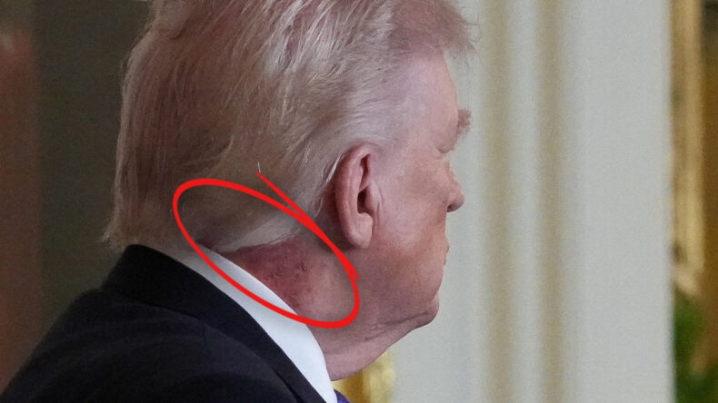 ABD&rsquo;de g&uuml;ndem Trump&rsquo;ın kızarıklığı