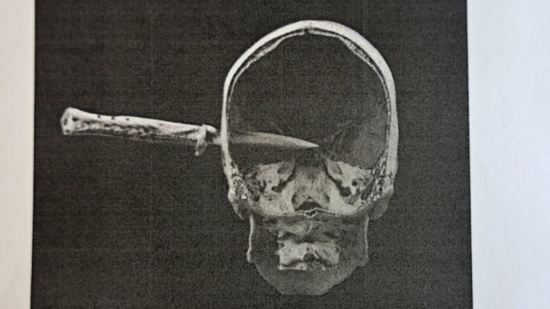 Almanya'yı sarsan cinayet: Nişanlısını d&ouml;vd&uuml;, kuzeninin kafasına bı&ccedil;ak sapladı