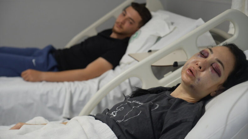 Anne ve Oğluna Kafede Saldırı: Yüzü Tanınmayacak Hale Geldi