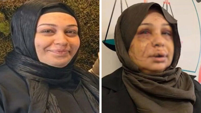 Eşini yaralayan polis memurunun davasında dikkat &ccedil;eken karar