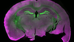 Fare Beyin Dokusunu Dondurdular, &Ccedil;&ouml;z&uuml;ld&uuml;ğ&uuml;nde Ortaya &Ccedil;ıkan Sonu&ccedil; Şaşırttı