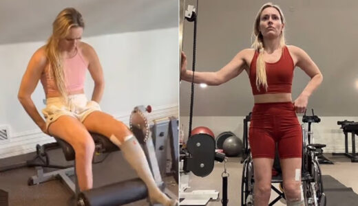 Lindsey Vonn'un inanılmaz d&ouml;n&uuml;ş&uuml;: Bacağı kesilebilirdi, 1 ayda spora başladı