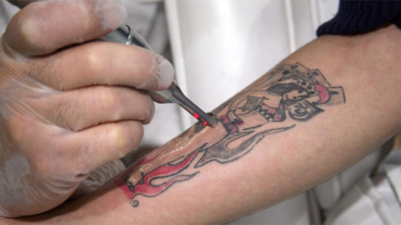 MHP'den d&ouml;vme, botoks ve piercing teklifi