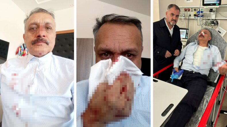 Okul m&uuml;d&uuml;r&uuml;, &ouml;ğrencinin ağabeyi tarafından darbedildi