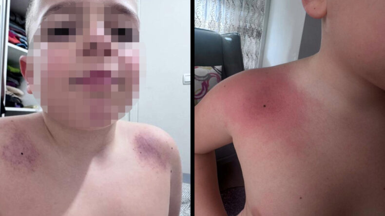 &Ouml;ğretmene darp soruşturması