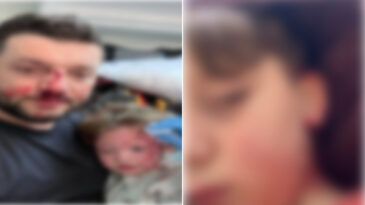 &Ouml;nce babayı kucağında bebeğiyle d&ouml;vd&uuml;ler, şimdi de oğluna taşla saldırdılar