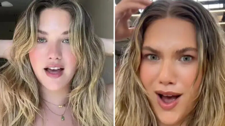 Popüler Sosyal Medya Akımı Saç Dökülmesine Yol Açıyor