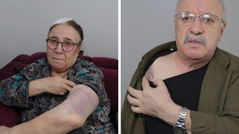 Yaşlı &ccedil;ifti sopayla d&ouml;vd&uuml;: &Ccedil;ok korkuyorum