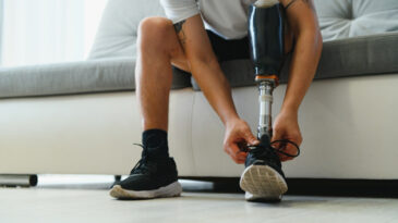 Yılda 12 bin kişi uzvunu kaybediyor