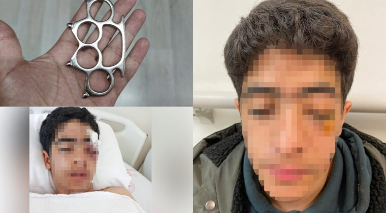 Akran zorbalığına bir yenisi eklendi: 15 yaşındaki &ccedil;ocuk muştayla &ouml;ld&uuml;resiye d&ouml;v&uuml;ld&uuml;