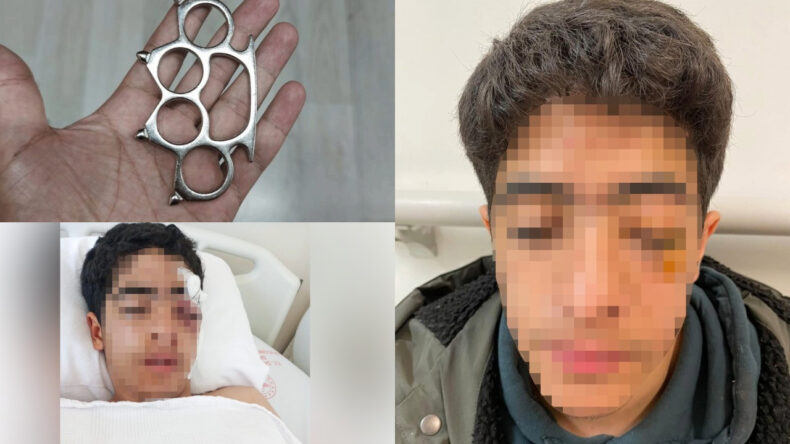 Akran zorbalığına bir yenisi eklendi: 15 yaşındaki &ccedil;ocuk muştayla &ouml;ld&uuml;resiye d&ouml;v&uuml;ld&uuml;