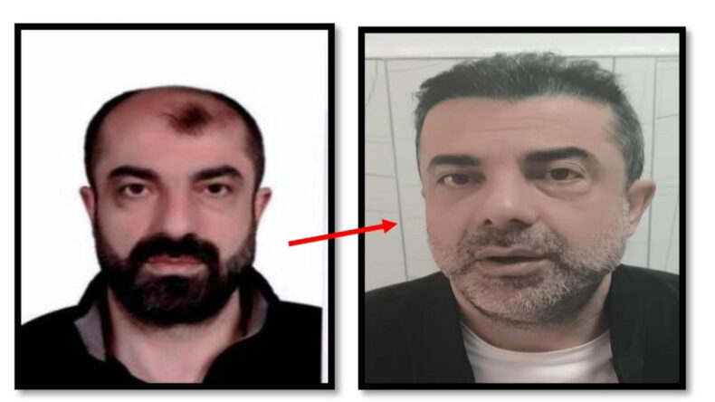 Ameliyatla Kardeşine Benzedi, 7 Yıl Ka&ccedil;tı