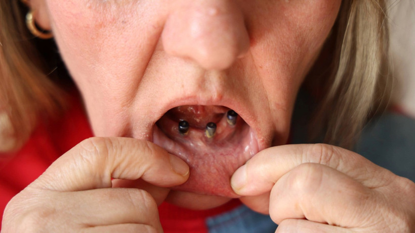 Gülbeyaz Çelikdemir'in sağlık durumu.