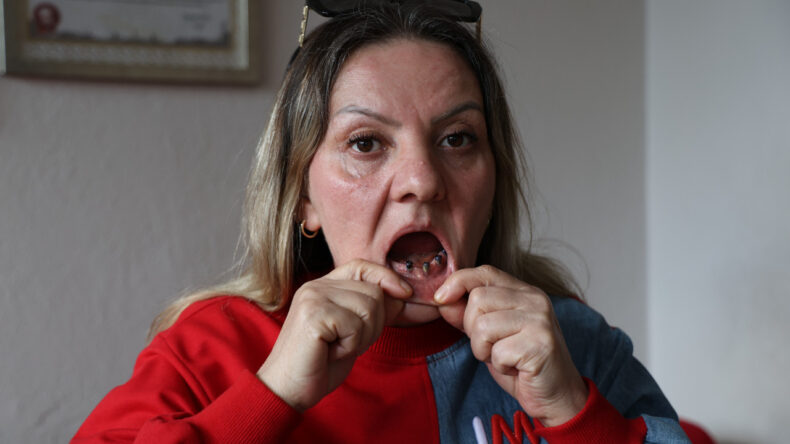 Bir G&uuml;nde 25 Dişi &Ccedil;ekildi, Hayatı Karardı