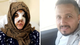 Boşanma aşamasındaki eşine vurduğu kaldırım taşı 'silah' sayıldı