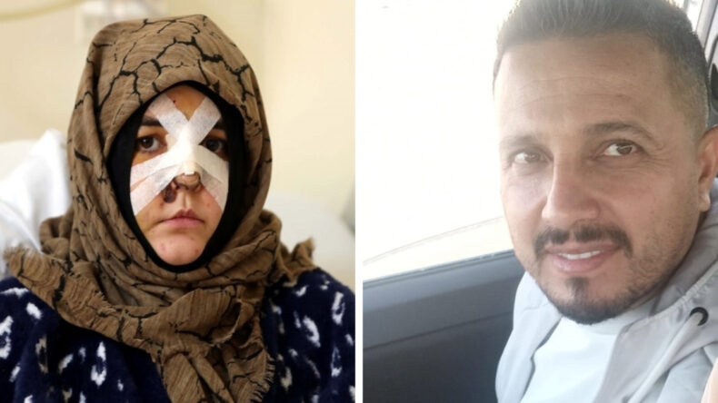 Boşanma aşamasındaki eşine vurduğu kaldırım taşı 'silah' sayıldı