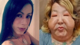 Dolgu yaptırmak istedi, hayatı karardı: Madeni yağ &ccedil;ıktı