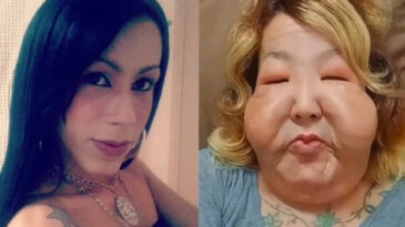 Dolgu yaptırmak istedi, hayatı karardı: Madeni yağ &ccedil;ıktı