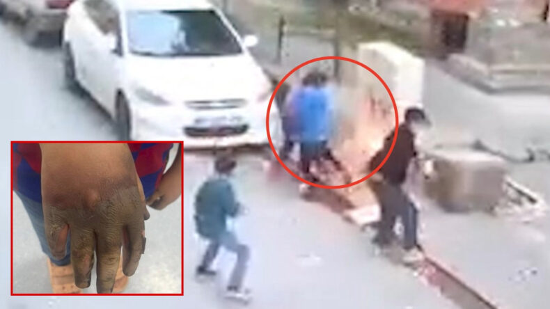 Elektrik Panosu Kabusu: Çocuğun Eli Kıvılcımlarla Yandı