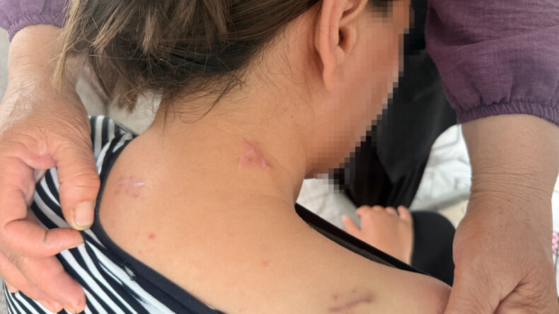 Eşi 17 yerinden bı&ccedil;akladı: Kızımın &ccedil;ığlıkları kulaklarımda