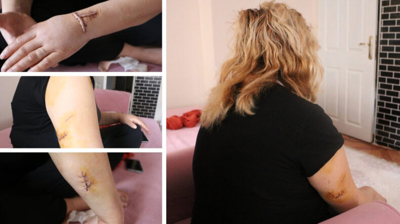 Eski sevgili dehşeti! Apartman girişinde pusu kurup 30 yerinden bı&ccedil;akladı