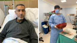 Karın ağrısı şikayetiyle gitti, karnından 8 kiloluk b&ouml;brek &ccedil;ıktı