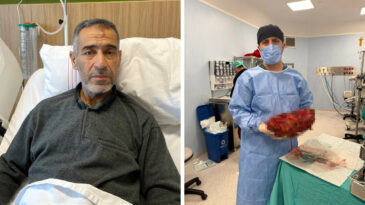 Karın ağrısı şikayetiyle gitti, karnından 8 kiloluk b&ouml;brek &ccedil;ıktı