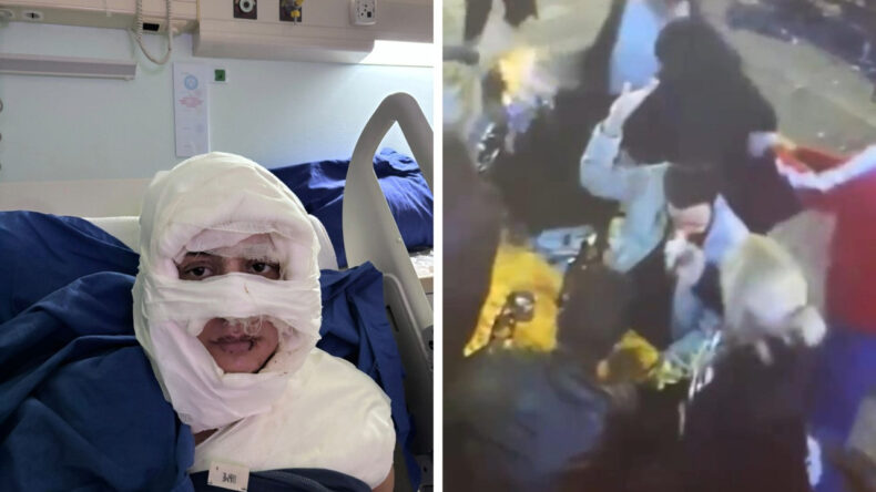 Kolonya d&ouml;k&uuml;p yakmıştı: Pişmanım