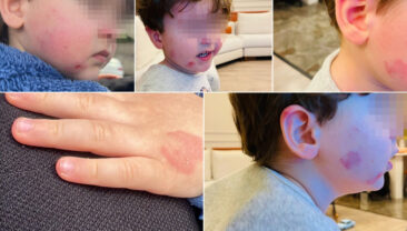 Kreşe bıraktığı 2 yaşındaki &ccedil;ocuğunu bu halde geri aldı