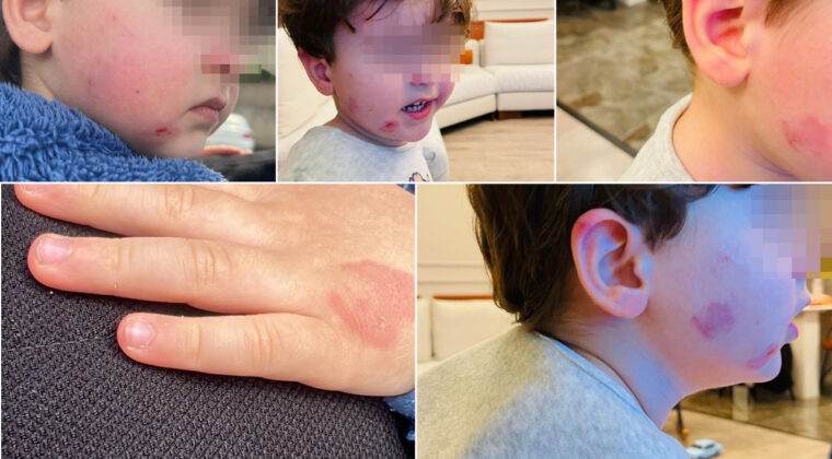 Kreşe bıraktığı 2 yaşındaki &ccedil;ocuğunu bu halde geri aldı