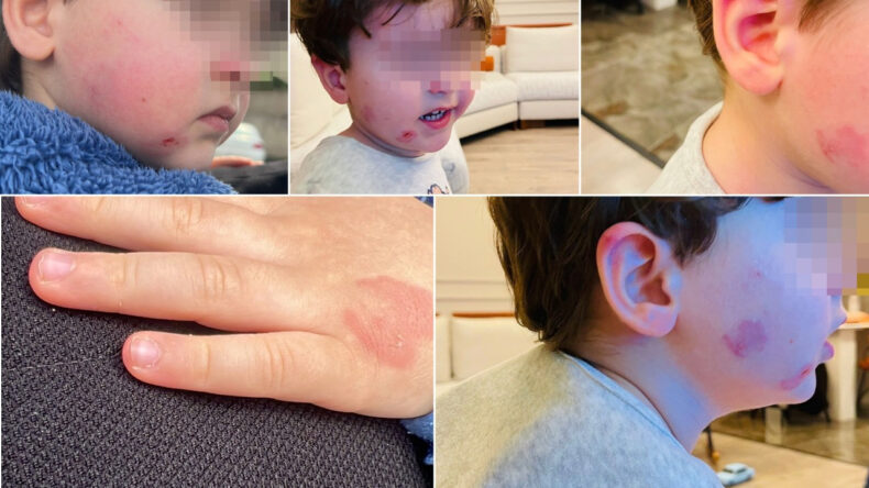 Kreşe bıraktığı 2 yaşındaki çocuğunu bu halde geri aldı