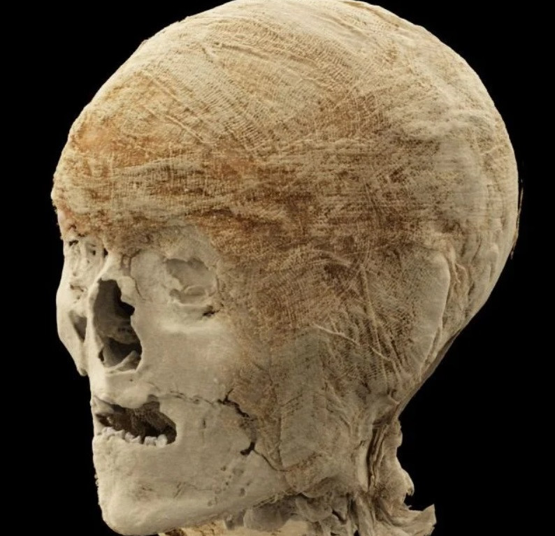 Antik Mısır mumyası