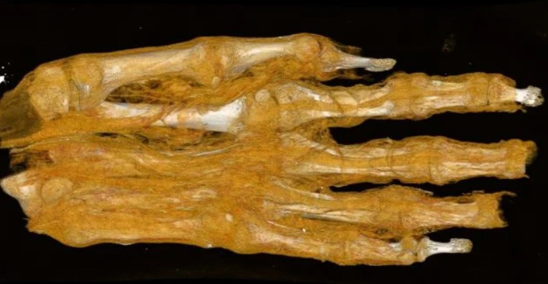 Antik Mısır mumyası taraması