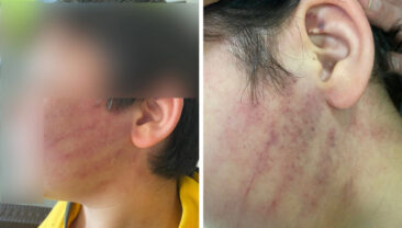 Okulu Basan Aile İki &Ccedil;ocuğu Darp Etti