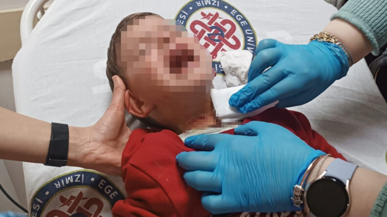 Parkta oynayan 2 yaşındaki &ccedil;ocuğa bı&ccedil;aklı saldırı