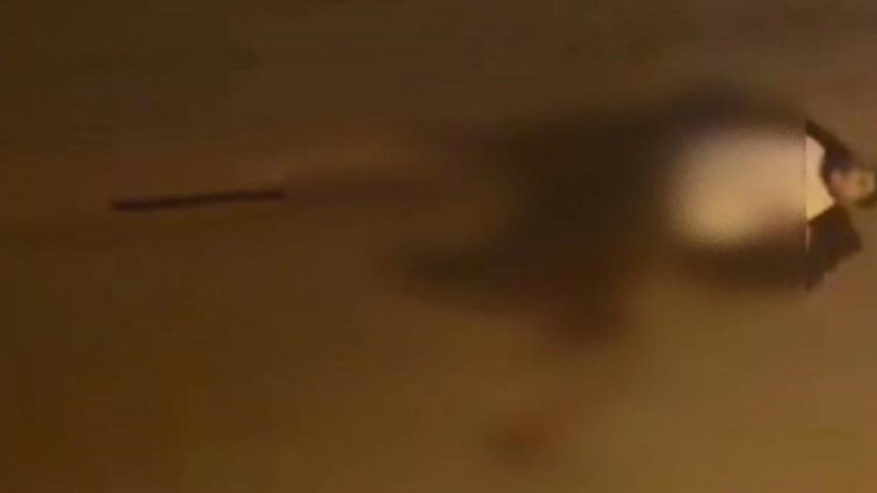 Sokak Ortasında Vuruldu, Ağır Yaralandı