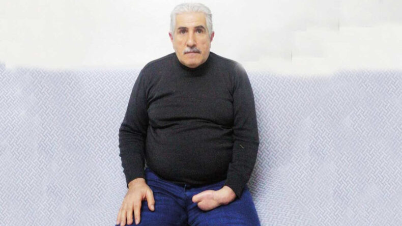 Tek Eli Olan Bir Adama Kim İş Verir?