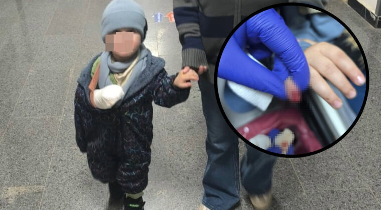 Y&uuml;r&uuml;yen merdivene kaptırdığı parmağı kurtarılamadı